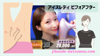 アイスレディカブリオレのビフォーアフター画像 | 自分で脱毛ドットコム