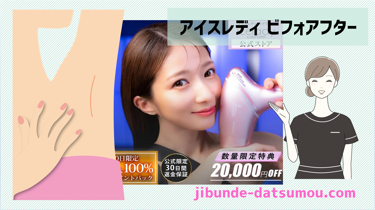 アイスレディカブリオレのビフォーアフター画像 | 自分で脱毛ドットコム